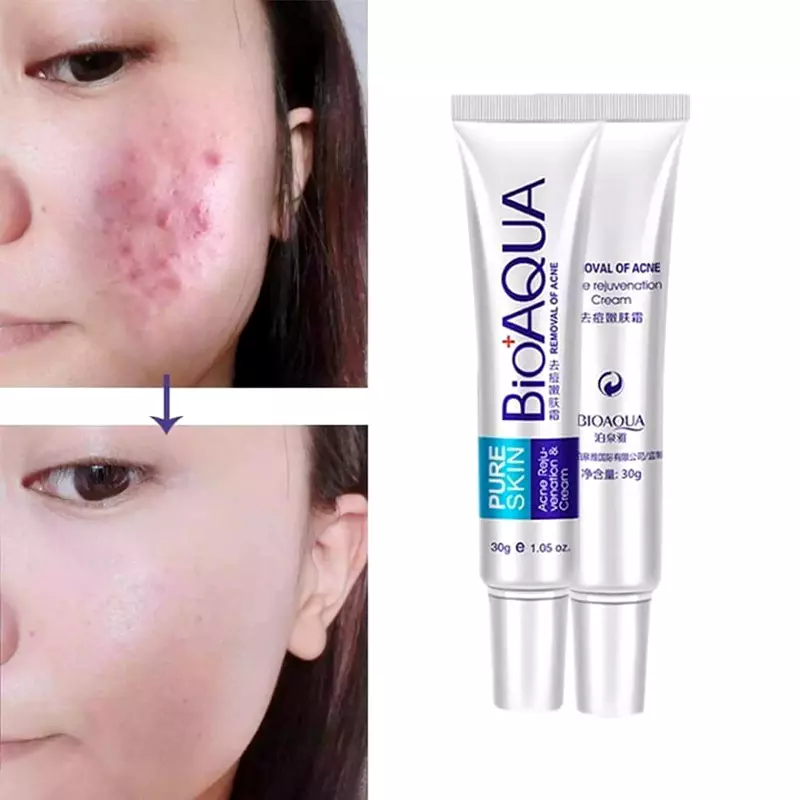 Bioaqua Pure Skin Acne Removal & Rejuvenation Cream For Men and Women-30g - Image 2