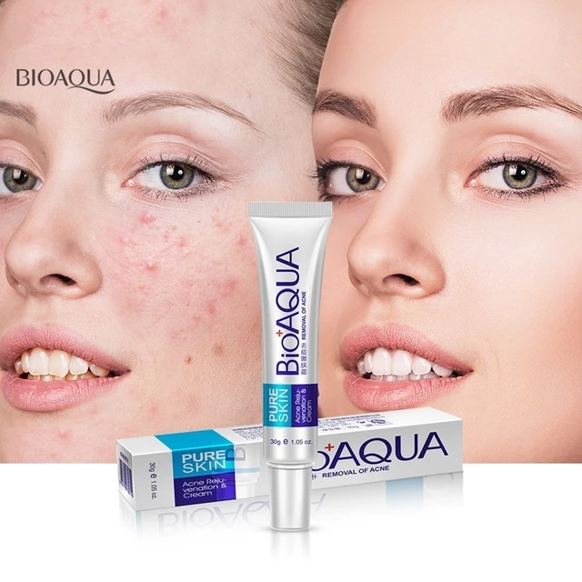 Bioaqua Pure Skin Acne Removal & Rejuvenation Cream For Men and Women-30g - Image 3